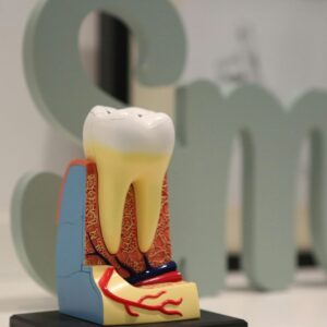 tooth replica