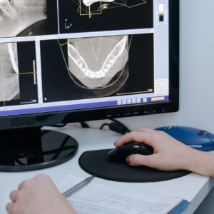 A person's hand uses a computer mouse while viewing a dental scan on a monitor.