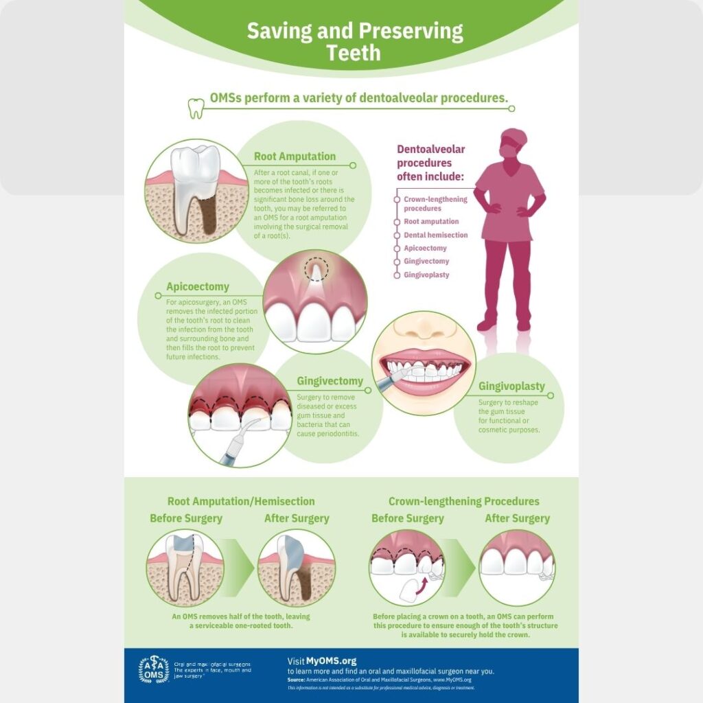 Preserving Your Natural Smile infographic